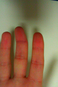 неровный палец